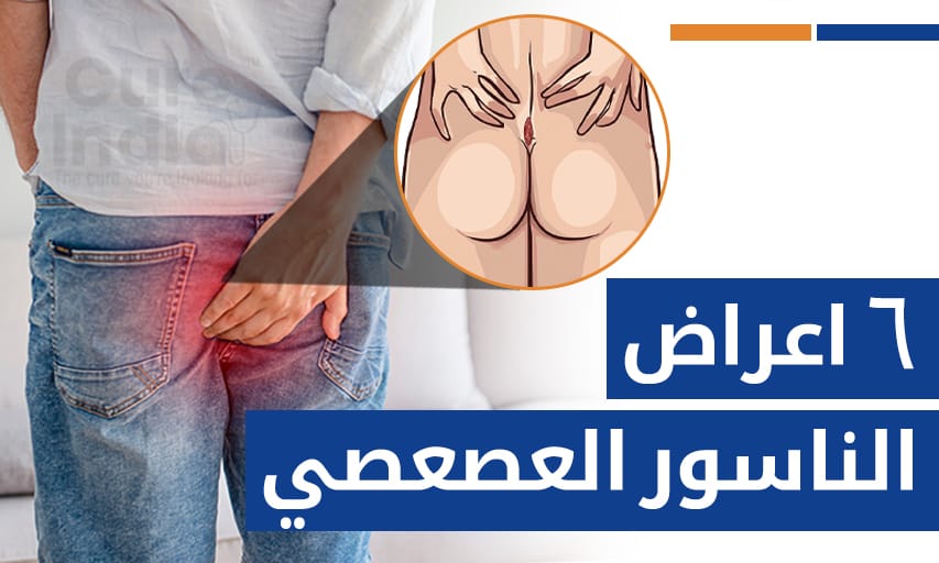 ٦ اعراض الناسور العصعصي تستحق زيارة طبيب المستقيم